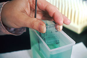 Lab technician bathing prepared slides in a so...